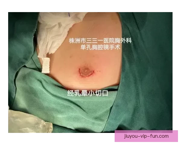 坎宁安气胸康复持续推进 活塞计划一周后复查评估